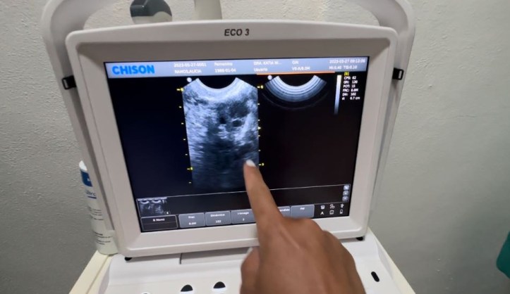 transvaginal ultrasound